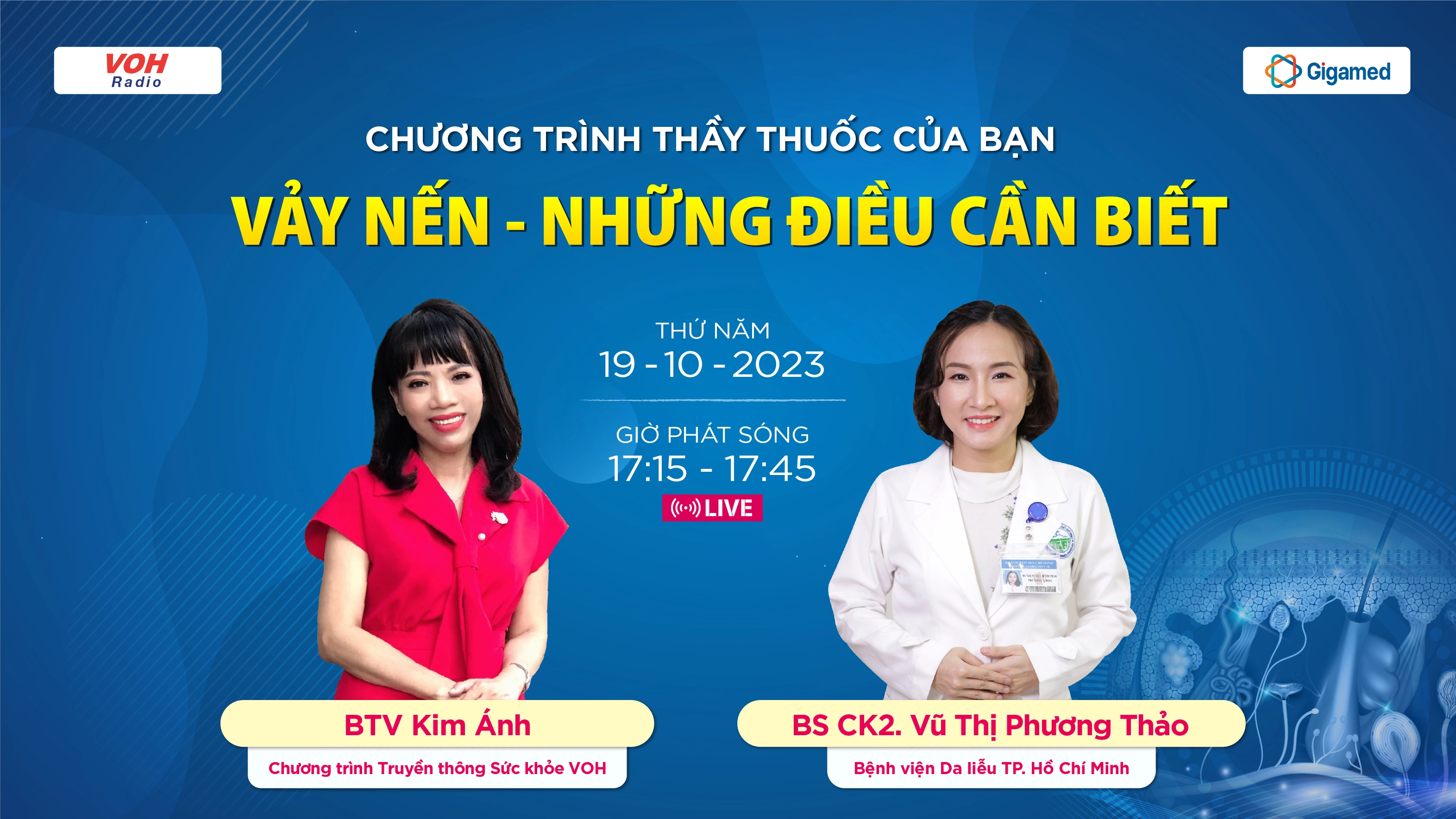 Bệnh Vảy nến - Nguyên nhân, triệu chứng thường gặp, điều trị